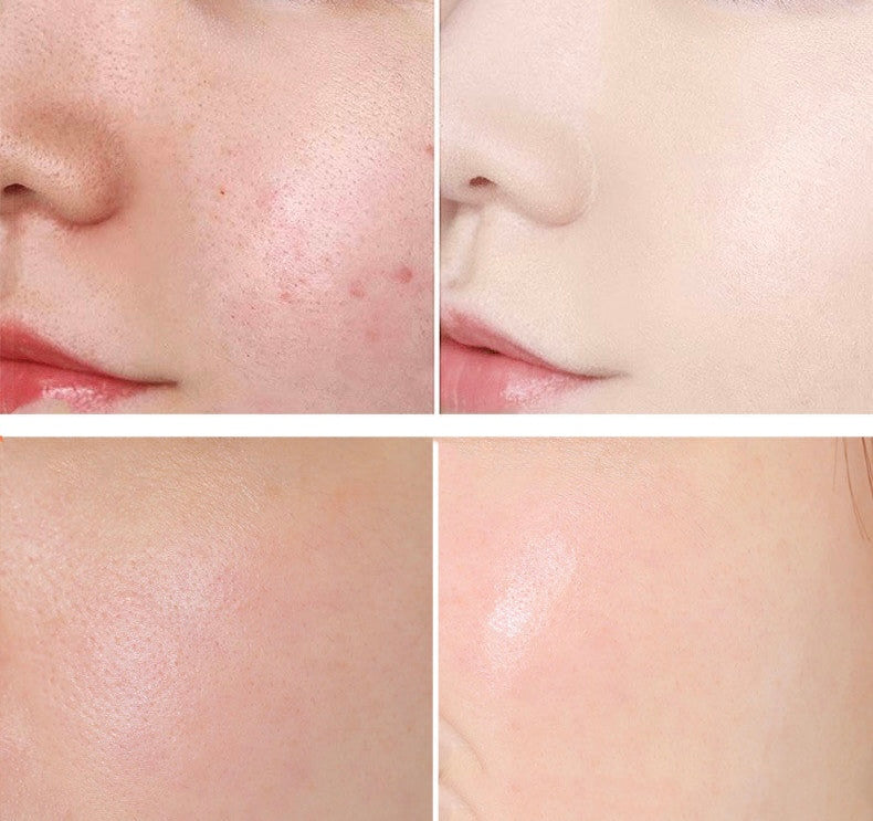 Serum de Ácido salicílico para el control del exceso de grasa y poros dilatados. - Tokio Beauty Skin