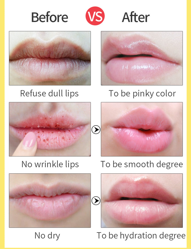 Lip Manteca de Karité Nutre, Hidrata, Bálsamo Labial para Reparar y Eliminar la Piel Muerta. - Tokio Beauty Skin