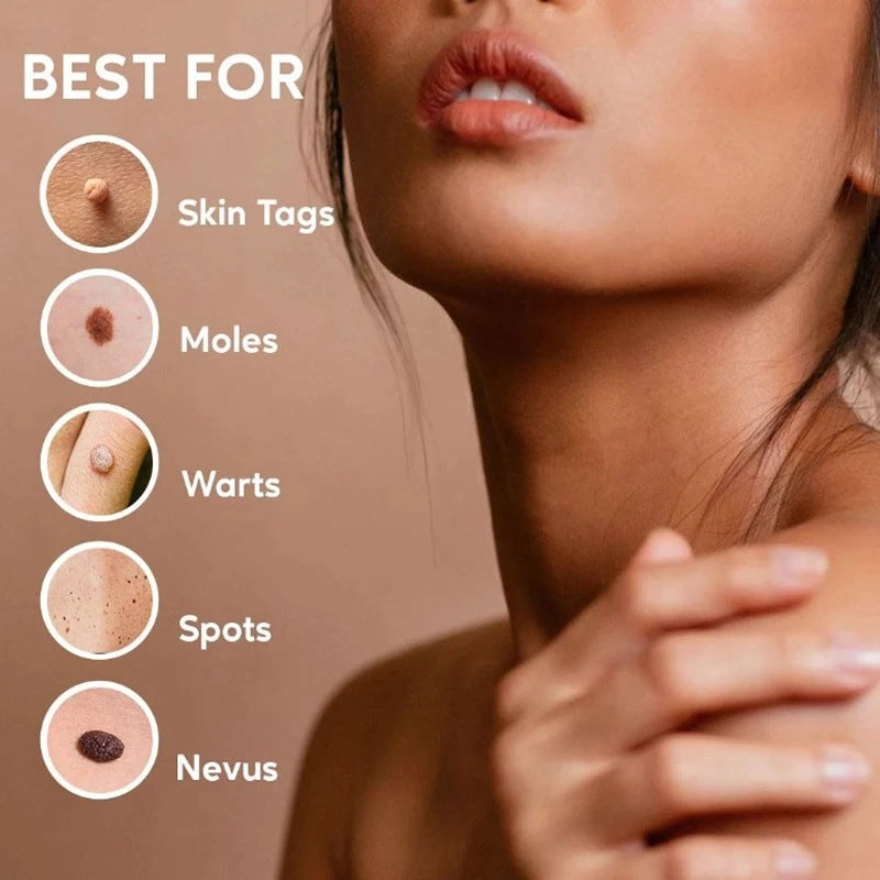 Líquido para Tratar, Suavizar y Reducir Verrugas - Tokio Beauty Skin
